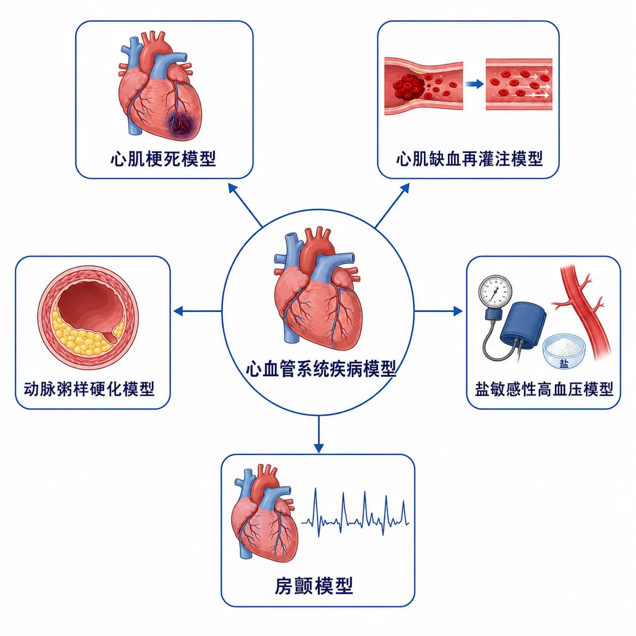 心血管疾病模型
