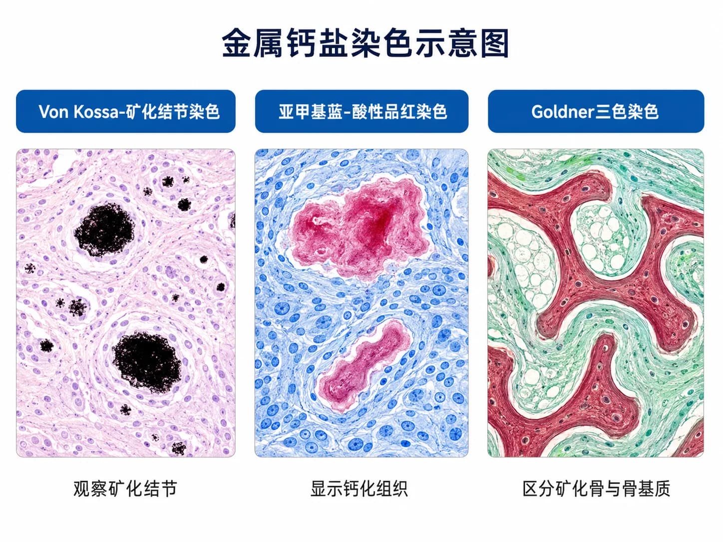 金属钙盐染色