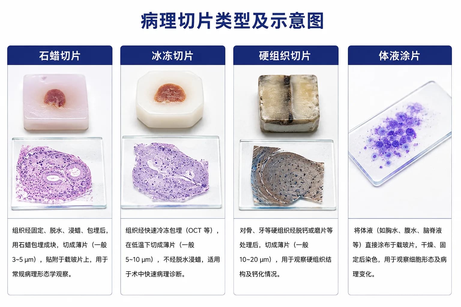 病理切片