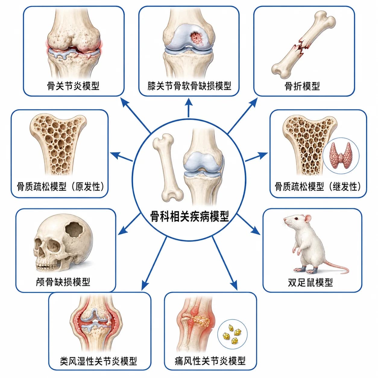 骨科疾病模型